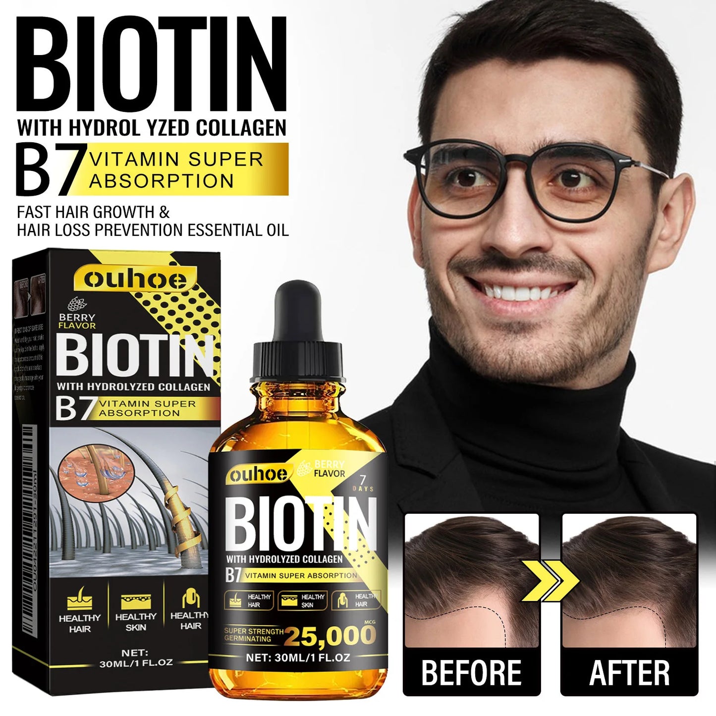 Ouhoe Collagen B7 Hair Growth Serum Oil for Scalp Care